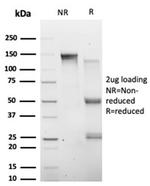 HIC2 (Hypermethylated in cancer 2) (Transcriptional Repressor) Antibody in SDS-PAGE (SDS-PAGE)