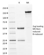 Filaggrin Antibody in SDS-PAGE (SDS-PAGE)