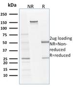 Filaggrin (Keratinocyte Differentiation Marker) Antibody in SDS-PAGE (SDS-PAGE)