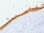 Filaggrin (Keratinocyte Differentiation Marker) Antibody in Immunohistochemistry (Paraffin) (IHC (P))