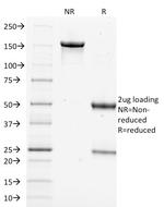 Filaggrin (Keratinocyte Differentiation Marker) Antibody in SDS-PAGE (SDS-PAGE)