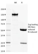 Filaggrin (Keratinocyte Differentiation Marker) Antibody in SDS-PAGE (SDS-PAGE)