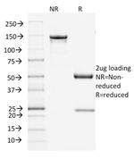 Filaggrin (Keratinocyte Differentiation Marker) Antibody in SDS-PAGE (SDS-PAGE)