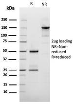 Filaggrin (Keratinocyte Differentiation Marker) Antibody in SDS-PAGE (SDS-PAGE)