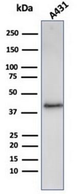 Filaggrin (Keratinocyte Differentiation Marker) Antibody in Western Blot (WB)