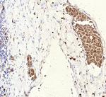 FLI1 (Ewing's Sarcoma and Endothelial Marker) Antibody in Immunohistochemistry (Paraffin) (IHC (P))