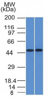 FLI1 (Ewing's Sarcoma and Endothelial Marker) Antibody in Western Blot (WB)