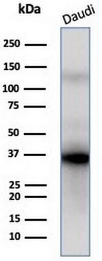 FLI1 (Ewing's Sarcoma and Endothelial Marker) Antibody in Western Blot (WB)