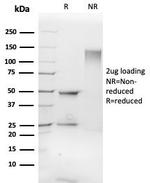 FLI1 (Ewing's Sarcoma and Endothelial Marker) Antibody in SDS-PAGE (SDS-PAGE)