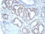 FLI1 (Ewing's Sarcoma and Endothelial Marker) Antibody in Immunohistochemistry (Paraffin) (IHC (P))