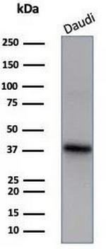 FLI1 (Ewing's Sarcoma and Endothelial Marker) Antibody in Western Blot (WB)