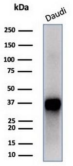 FLI1 (Ewing's Sarcoma and Endothelial Marker) Antibody in Western Blot (WB)