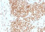 FLI1 (Ewing's Sarcoma and Endothelial Marker) Antibody in Immunohistochemistry (Paraffin) (IHC (P))