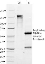 MART-1/Melan-A/MLANA (Melanoma Marker) Antibody in SDS-PAGE (SDS-PAGE)