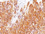 MART-1/Melan-A/MLANA (Melanoma Marker) Antibody in Immunohistochemistry (Paraffin) (IHC (P))