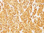 MART-1/Melan-A/MLANA (Melanoma Marker) Antibody in Immunohistochemistry (Paraffin) (IHC (P))