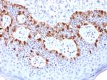 MART-1/Melan-A/MLANA Antibody in Immunohistochemistry (Paraffin) (IHC (P))