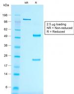 MART-1/Melan-A/MLANA Antibody in SDS-PAGE (SDS-PAGE)