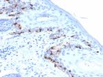 MART-1/Melan-A/MLANA Antibody in Immunohistochemistry (Paraffin) (IHC (P))