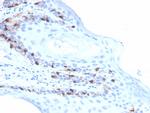 MART-1/Melan-A/MLANA Antibody in Immunohistochemistry (Paraffin) (IHC (P))