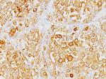 MART-1/Melan-A/MLANA (Melanoma Marker) Antibody in Immunohistochemistry (Paraffin) (IHC (P))