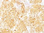 MART-1/Melan-A/MLANA (Melanoma Marker) Antibody in Immunohistochemistry (Paraffin) (IHC (P))