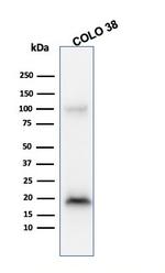 MART-1/Melan-A/MLANA (Melanoma Marker) Antibody in Western Blot (WB)