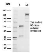 MART-1/Melan-A/MLANA (Melanoma Marker) Antibody in SDS-PAGE (SDS-PAGE)