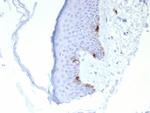 MART-1/Melan-A/MLANA (Melanoma Marker) Antibody in Immunohistochemistry (Paraffin) (IHC (P))