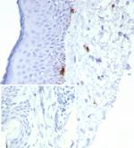 MART-1/Melan-A/MLANA (Melanoma Marker) Antibody in Immunohistochemistry (Paraffin) (IHC (P))