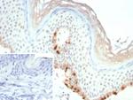 MART-1/Melan-A/MLANA (Melanoma Marker) Antibody in Immunohistochemistry (Paraffin) (IHC (P))