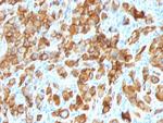 MART-1/Melan-A/MLANA (Melanoma Marker) Antibody in Immunohistochemistry (Paraffin) (IHC (P))