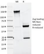 MART-1/Melan-A/MLANA (Melanoma Marker) Antibody in SDS-PAGE (SDS-PAGE)