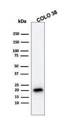 MART-1/Melan-A/MLANA (Melanoma Marker) Antibody in Western Blot (WB)