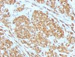 MART-1/Melan-A/MLANA (Melanoma Marker) Antibody in Immunohistochemistry (Paraffin) (IHC (P))