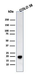 MART-1/Melan-A/MLANA (Melanoma Marker) Antibody in Western Blot (WB)