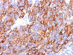 MART-1/Melan-A/MLANA (Melanoma Marker) Antibody in Immunohistochemistry (Paraffin) (IHC (P))