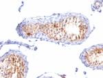 MART-1/Melan-A/MLANA (Melanoma Marker) Antibody in Immunohistochemistry (Paraffin) (IHC (P))