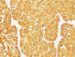 MART-1/Melan-A/MLANA (Melanoma Marker) Antibody in Immunohistochemistry (Paraffin) (IHC (P))