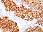 MART-1/Melan-A/MLANA (Melanoma Marker) Antibody in Immunohistochemistry (Paraffin) (IHC (P))