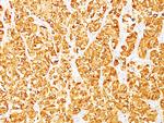 MART-1/Melan-A/MLANA (Melanoma Marker) Antibody in Immunohistochemistry (Paraffin) (IHC (P))