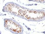 MART-1/Melan-A/MLANA (Melanoma Marker) Antibody in Immunohistochemistry (Paraffin) (IHC (P))