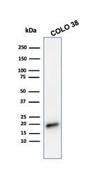 MART-1/Melan-A/MLANA (Melanoma Marker) Antibody in Western Blot (WB)