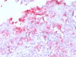 MART-1/Melan-A/MLANA Antibody in Immunohistochemistry (Paraffin) (IHC (P))