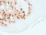 MART-1/Melan-A/MLANA Antibody in Immunohistochemistry (Paraffin) (IHC (P))