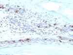 MART-1/Melan-A/MLANA Antibody in Immunohistochemistry (Paraffin) (IHC (P))