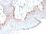 MART-1/Melan-A/MLANA (Melanoma Marker) Antibody in Immunohistochemistry (Paraffin) (IHC (P))