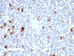 MART-1/Melan-A/MLANA (Melanoma Marker) Antibody in Immunohistochemistry (Paraffin) (IHC (P))