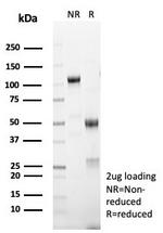 MART-1/Melan-A/MLANA (Melanoma Marker) Antibody in SDS-PAGE (SDS-PAGE)