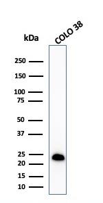 MART-1/Melan-A/MLANA Antibody in Western Blot (WB)